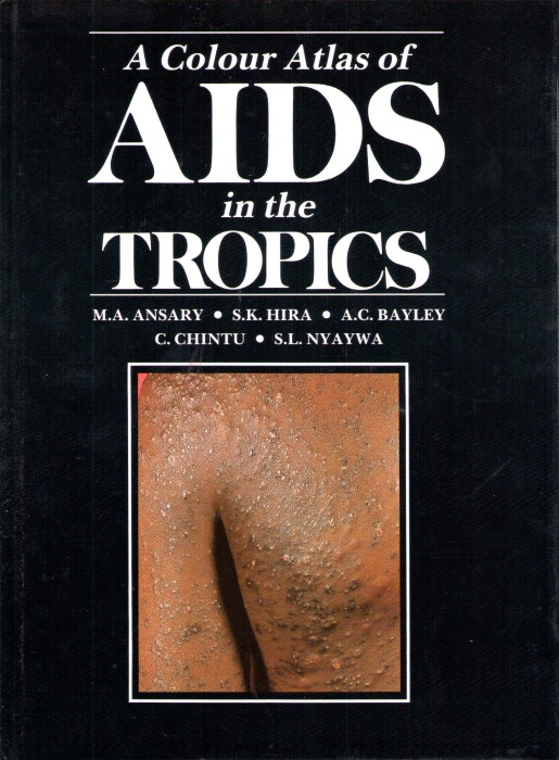 Ansary, M.A. et al - A Colour Atlas of Aids in the Tropics